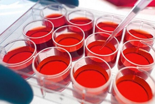 Foto - Parkinson hastalığı için umut doğdu