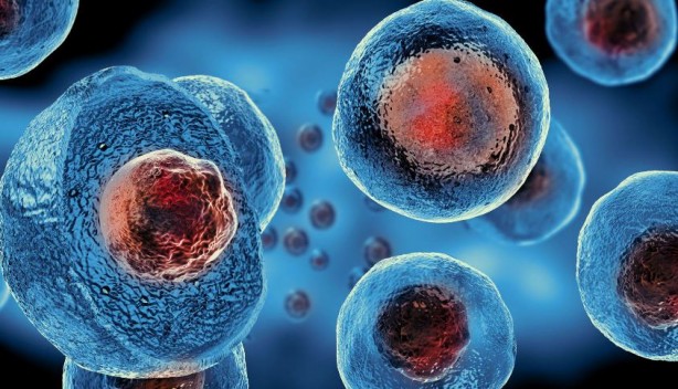 Foto - Parkinson hastalığı için umut doğdu