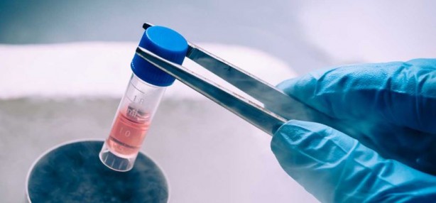 Foto - Parkinson hastalığı için umut doğdu