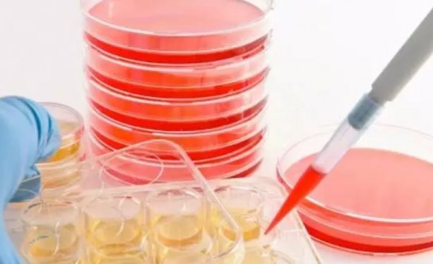 Foto - Parkinson hastalığı için umut doğdu