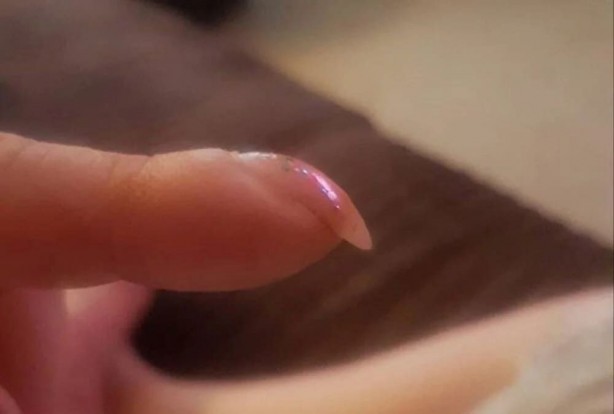 Foto - Parmak testiyle akciğer kanseri riskinizi öğrenin! İşte o hayati test...