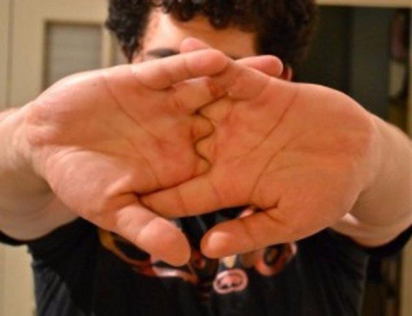 Foto - Parmaklar neden çıtlar?