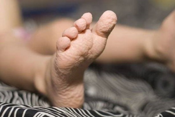 Foto - Parmaklar suda neden buruşur? İşte büyük mucize