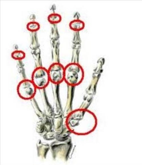 Foto - Parmaklarımız neden çıtlar? Çok şaşıracaksınız