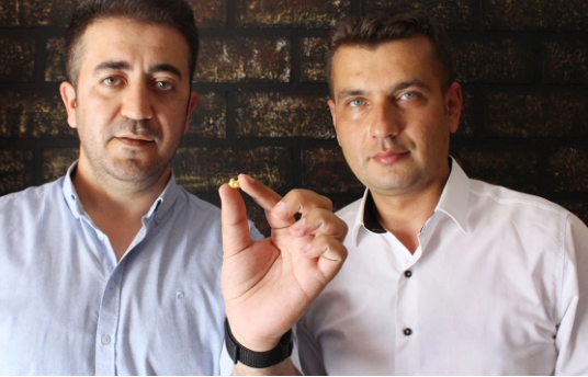 Foto - Patatesle her gün evde altın üretiyorlar! İnternette görüp denediler, başarılı sonuç verdi