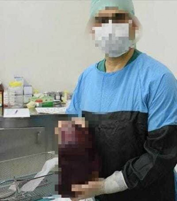 Foto - Patolojiye gönderilen 'dalak' kargoda kaybolmuştu...Karara tepki: Elinizi vicdanınıza koyun!