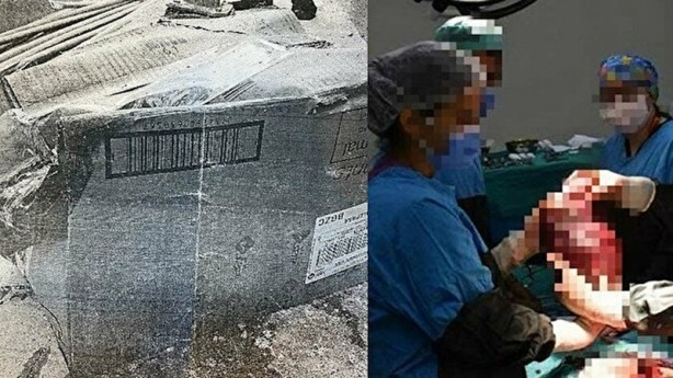 Patolojiye gönderilen 'dalak' kargoda kaybolmuştu...Karara tepki: Elinizi vicdanınıza koyun!