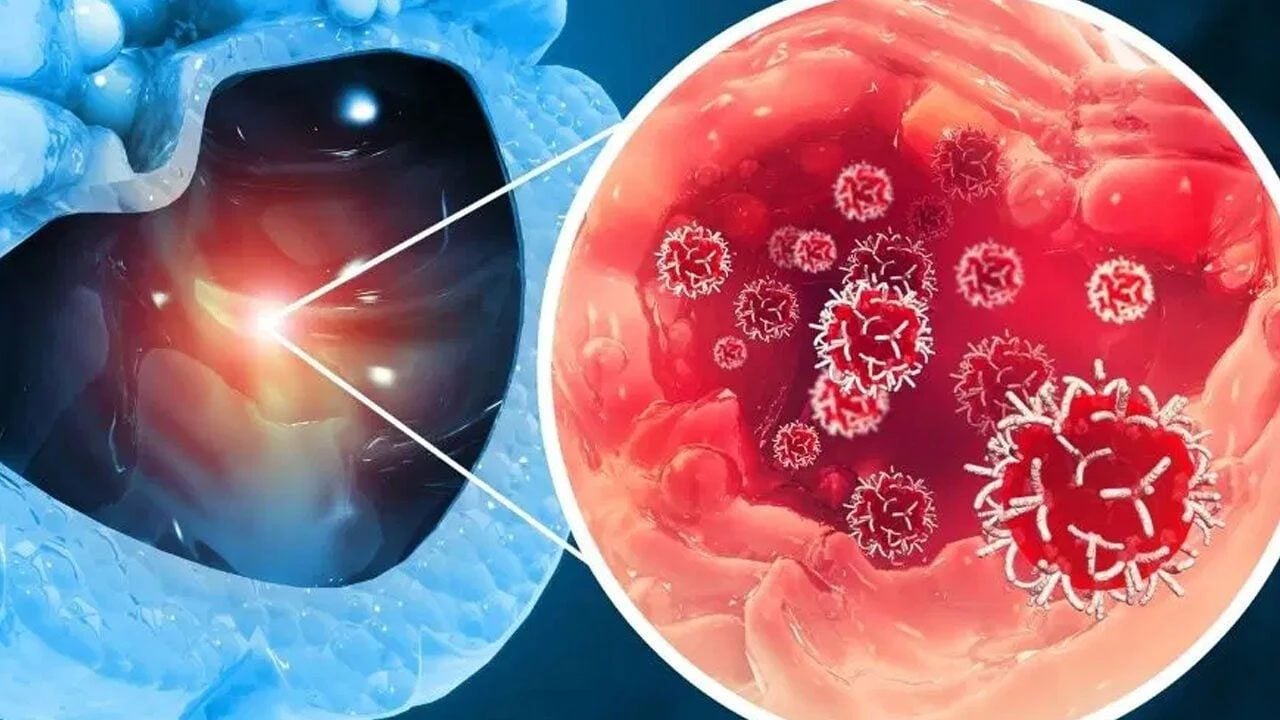 Pet şişe kanser yapıyor: Risk bulundu! Almanya'dan çağrı yapıldı