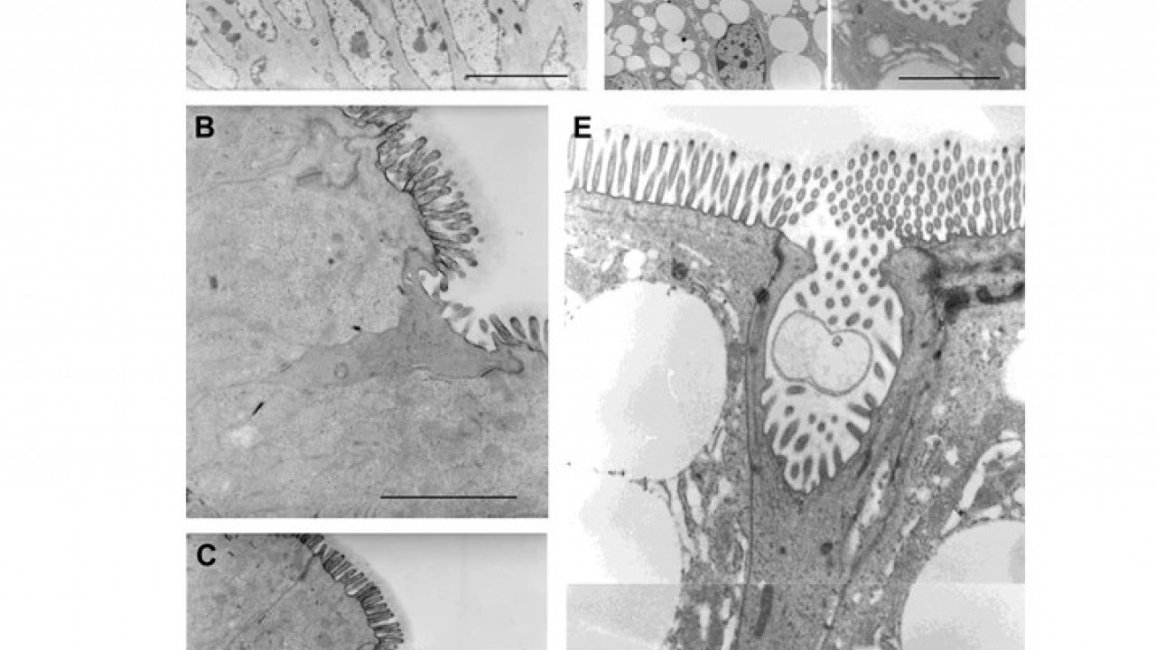 Foto - Pitonların sırrı ortaya çıktı! Kemikleri bile sindiren inanılmaz mekanizma