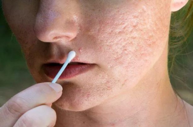 Plastik çatallarla inanılmaz gerçekleşti! İşte daha önce duymadığınız şeyler...