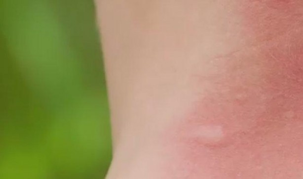 Foto - Plastik çatallarla inanılmaz gerçekleşti! İşte daha önce duymadığınız şeyler...