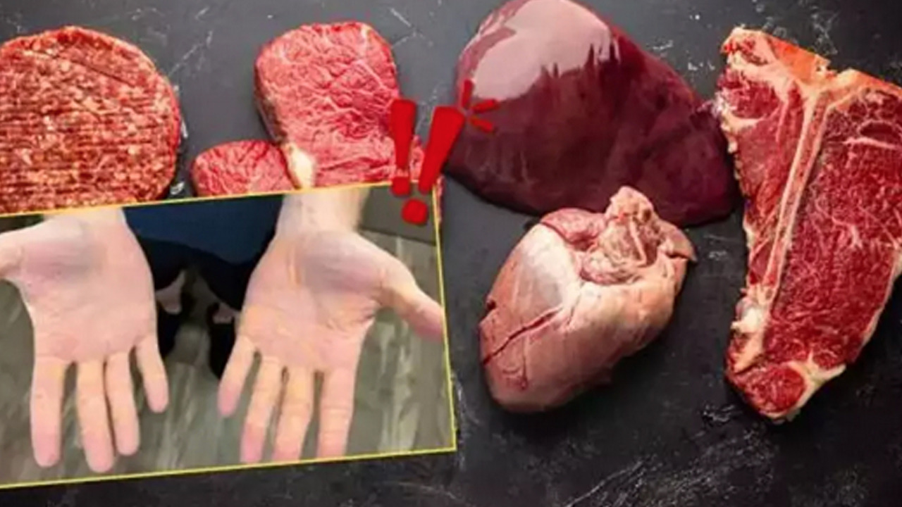 Etobur Diyeti nedir? Popüler diyet onu bakın ne hale getirdi!: Başına bela oldu! Kansere bile yol açabilir 