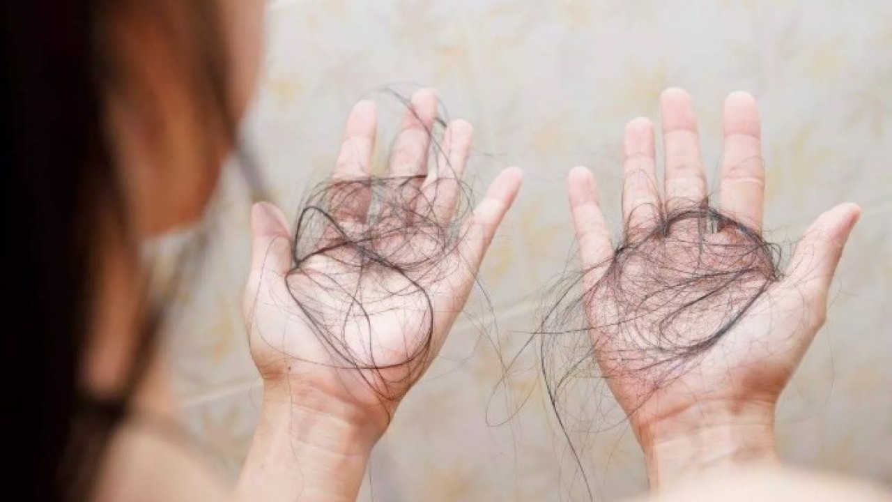 Foto - Portekizli uzmanlar uyardı: Bu içecekler saç döküyor!