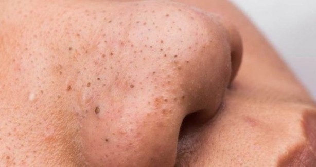 Foto - Poşet çayın hayatınızı kolaylaştıracak faydaları