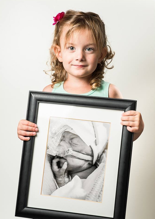 Foto - Prematüre bebeklerin inanılmaz değişimi