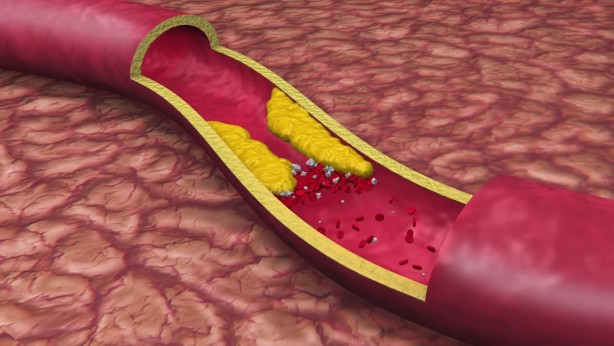 Foto - Prof. Dr. Canan Karatay öneriyor! Omega-3 içeren besinlere yer açın