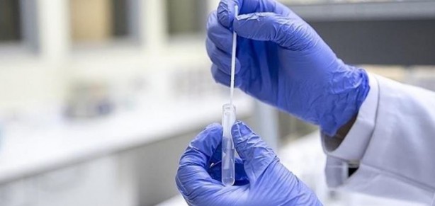 Foto - Prof. Dr. Mehmet Ceyhan’dan 'X Hastalığı' yorumu