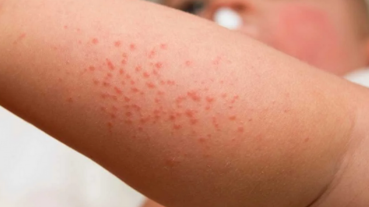 Foto - Prof. Dr. Murat Baş: Sağlıklı bir cilt için önce bağırsaklarınızı iyileştirin diyor! 