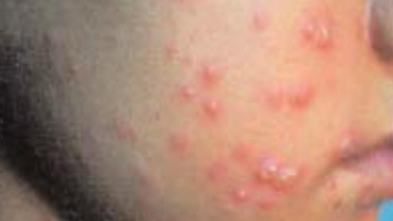 Prof. Dr. Murat Baş: Sağlıklı bir cilt için önce bağırsaklarınızı iyileştirin diyor! 