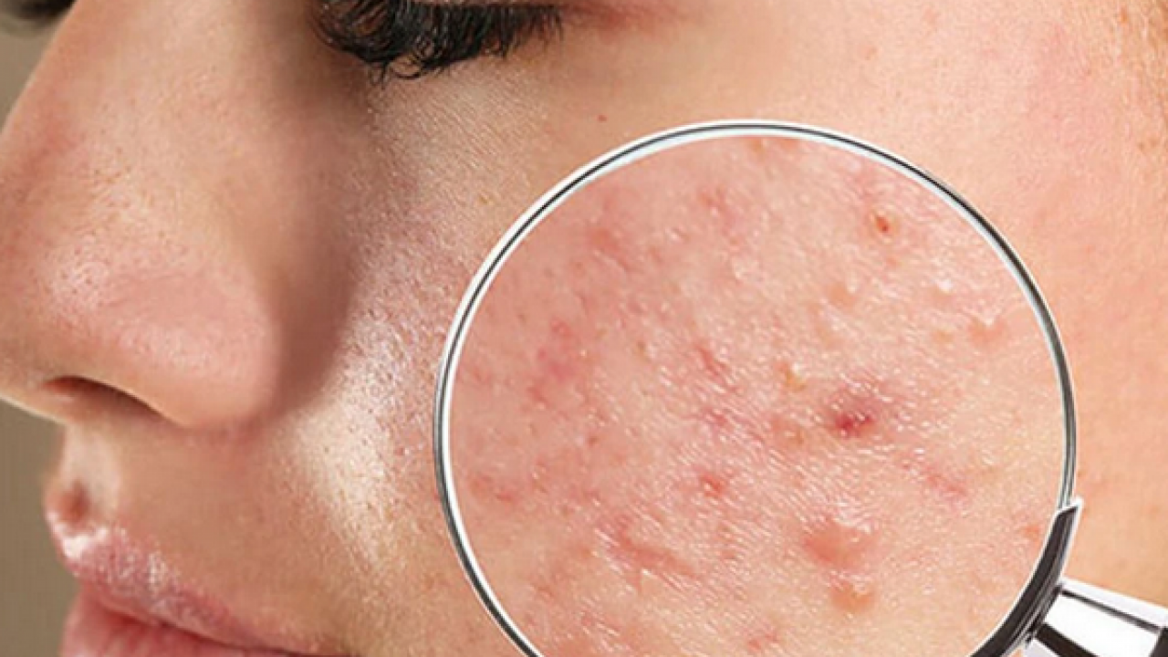 Foto - Prof. Dr. Murat Baş: Sağlıklı bir cilt için önce bağırsaklarınızı iyileştirin diyor! 