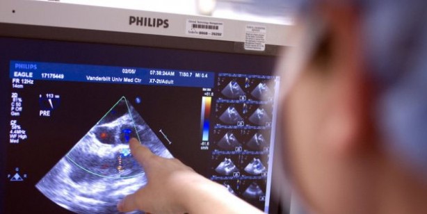 Tekrarlayıcı gebelik kaybında stres, obezite, sigara, alkol ve kafein risk faktörüdür