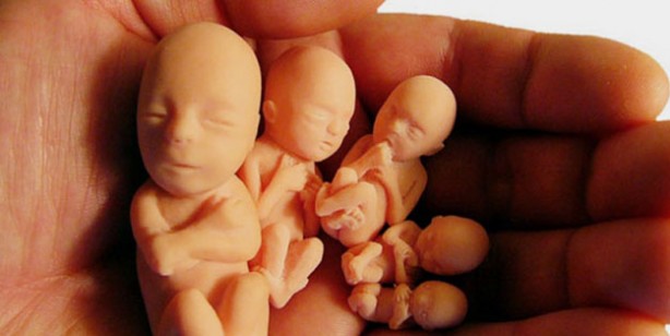 Foto - Tekrarlayıcı gebelik kaybında stres, obezite, sigara, alkol ve kafein risk faktörüdür