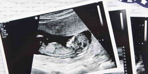 Foto - Tekrarlayıcı gebelik kaybında stres, obezite, sigara, alkol ve kafein risk faktörüdür