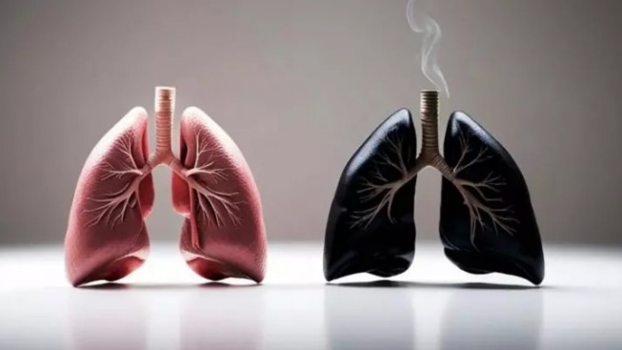 Foto - Profesörden kadınlara uyarı: 10 yıl içinde hızla artacak