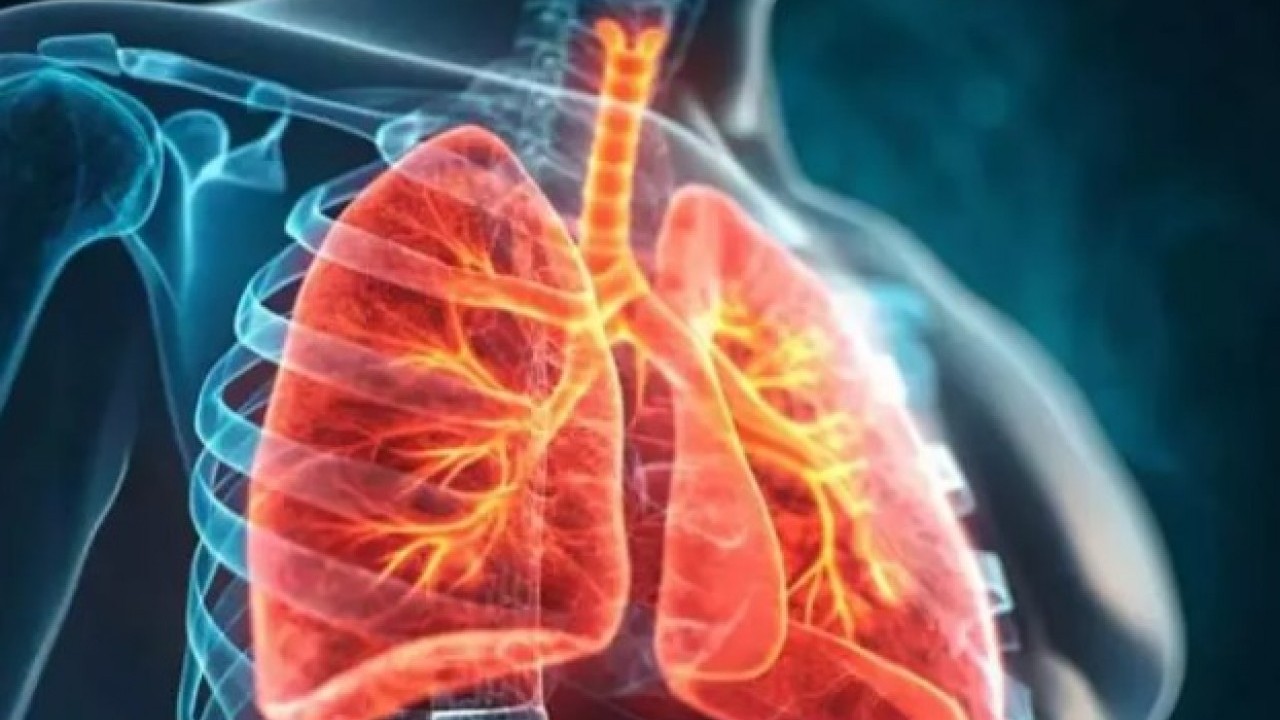 Foto - Profesörden kadınlara uyarı: 10 yıl içinde hızla artacak