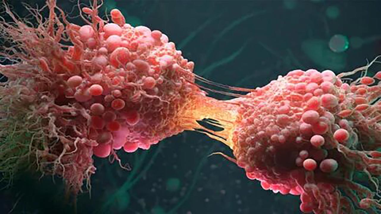 Foto - Prostat kanserinde yaş düşüyor! İşte hastalığı tetikleyen sıkıntılı faktörler