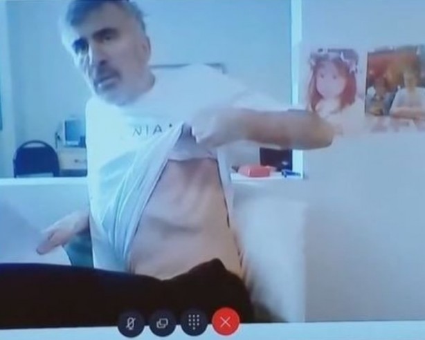 Foto - "Putin öldürecek" deniyordu... Aylar sonra açıklama yaptı! Son hali inanılmaz...