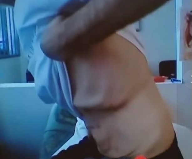 Foto - "Putin öldürecek" deniyordu... Aylar sonra açıklama yaptı! Son hali inanılmaz...