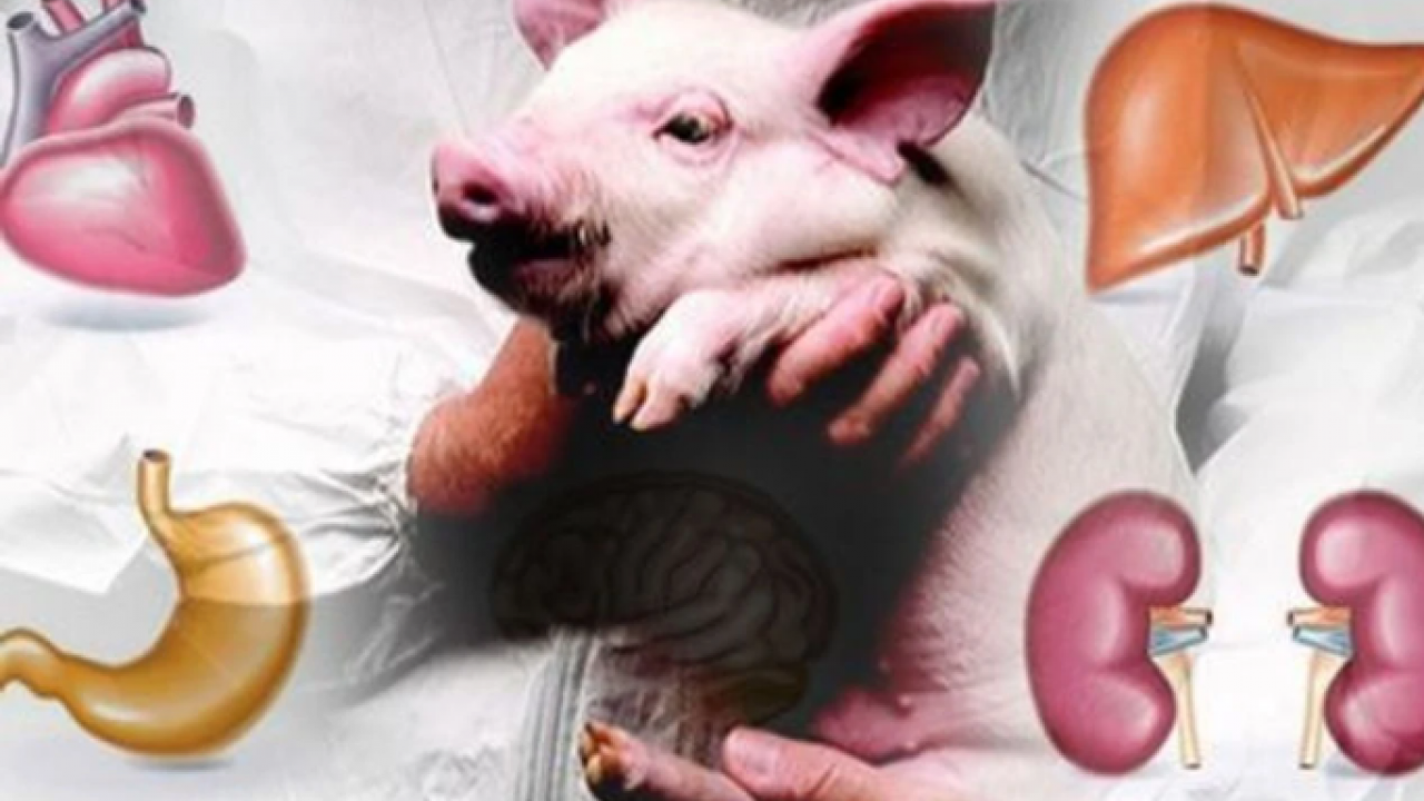 Foto - Putin ve Şi ne demek istedi? Gençlik aşısını buldular mı? Beyinsiz bedenler, domuz ve organları