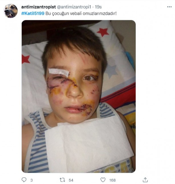 Foto - Rabia Kallı hayatını kaybetti, minik Mahra yoğun bakımda! 'Başıboş köpek terörü'ne tepkiler çığ gibi büyüyor!