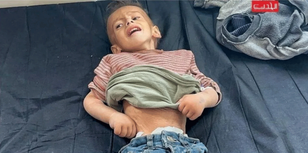 Foto - Ramazan Gazze’de ölüm ayı oldu! Dünya böyle bir soykırım görmedi: Çocuklar artık açlıktan yürüyemiyor