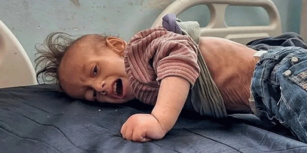 Foto - Ramazan Gazze’de ölüm ayı oldu! Dünya böyle bir soykırım görmedi: Çocuklar artık açlıktan yürüyemiyor