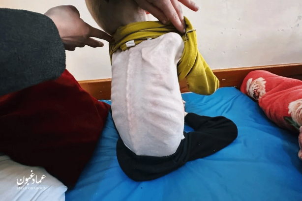 Foto - Ramazan Gazze’de ölüm ayı oldu! Dünya böyle bir soykırım görmedi: Çocuklar artık açlıktan yürüyemiyor