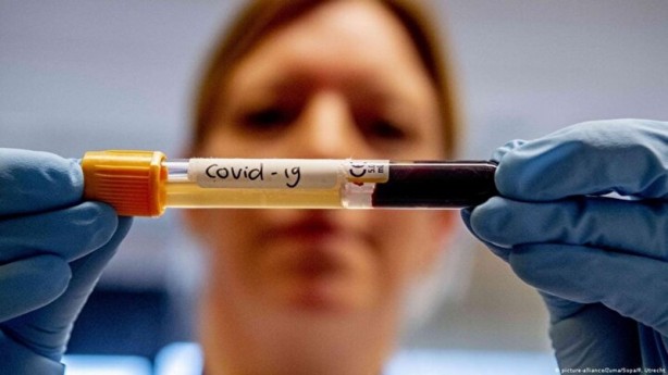 Foto - Resmi Gazete'de yayımlandı! İşte sağlık çalışanlarına yapılacak ek ödeme oranları