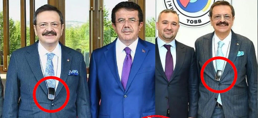 Foto - Rıfat Hisarcıklıoğlu’nun boynundaki alet! Herkes merak ediyordu Erdoğan da merak edip sordu