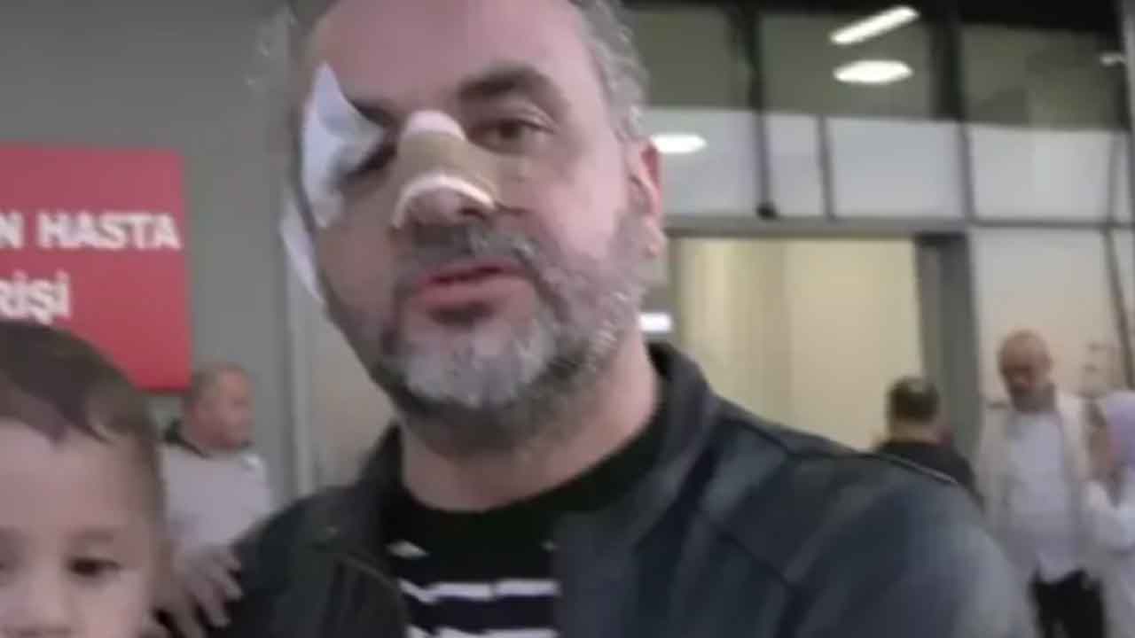 Foto - Rize'deki 'Burger King' açılışına katılan AK Partili başkandan şaşırtan savunma