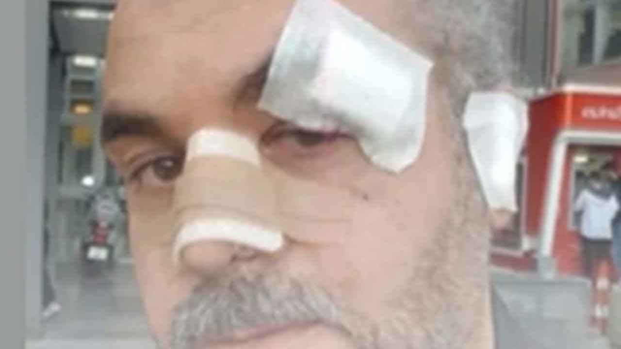 Foto - Rize'deki 'Burger King' açılışına katılan AK Partili başkandan şaşırtan savunma