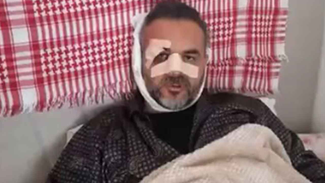 Foto - Rize'deki 'Burger King' açılışına katılan AK Partili başkandan şaşırtan savunma