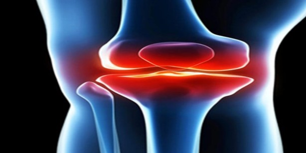 Foto - Romatizma kireçlenme eklem ağrısı için doğal krem! En etkili: Gerçek eklem ağrılarında etkisini gösterdi