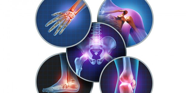 Foto - Romatizma kireçlenme eklem ağrısı için doğal krem! En etkili: Gerçek eklem ağrılarında etkisini gösterdi