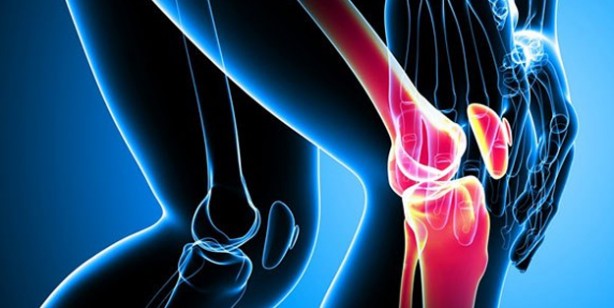 Foto - Romatizma kireçlenme eklem ağrısı için doğal krem! En etkili: Gerçek eklem ağrılarında etkisini gösterdi