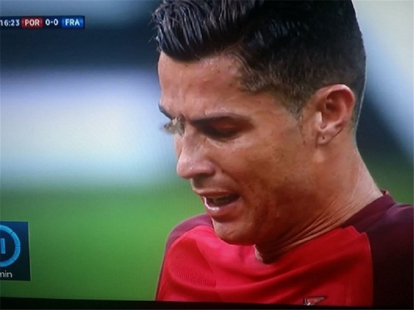 Ronaldo'nun yüzüne konan güve olay oldu