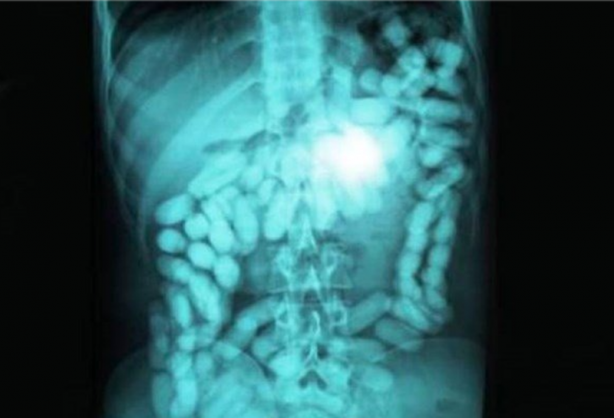 Foto - Röntgen sonrası çıkanlar doktorları bile şok etti! İşte açıklanamayan o görüntüler