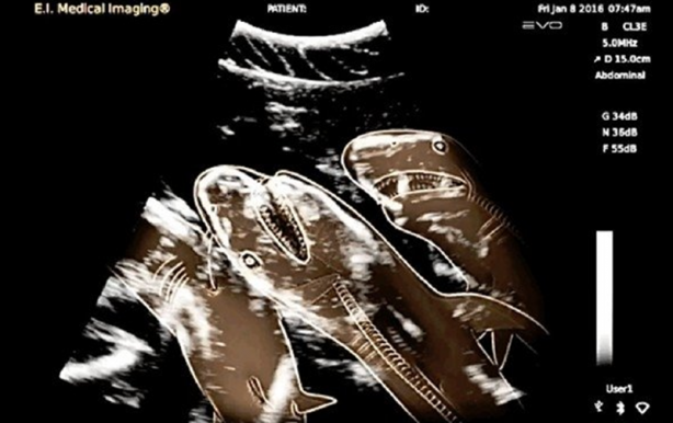 Foto - Röntgen sonrası çıkanlar doktorları bile şok etti! İşte açıklanamayan o görüntüler