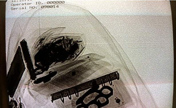 Foto - Röntgen sonrası çıkanlar doktorları bile şok etti! İşte açıklanamayan o görüntüler