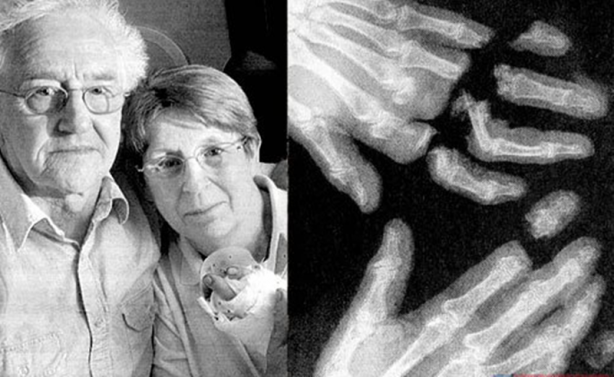 Foto - Röntgen sonrası çıkanlar doktorları bile şok etti! İşte açıklanamayan o görüntüler